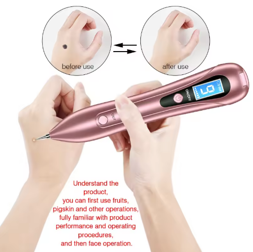 • آلة قلم ليزر لإزالة البقع الداكنة - الصورة 7